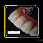Case2