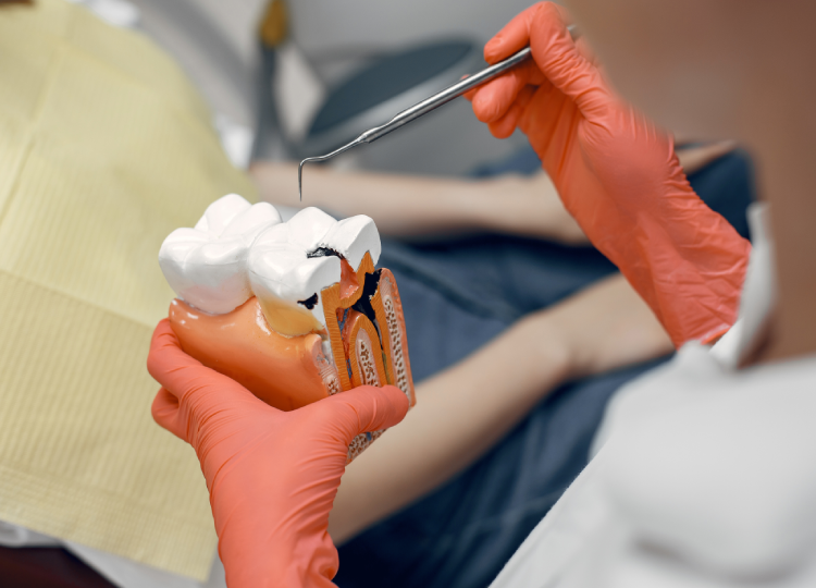 Root Canal Treatment