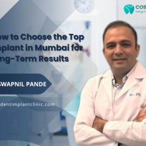 How to Choose the Top Implant in Mumbai for Long-Term Results