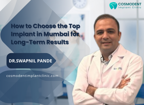How to Choose the Top Implant in Mumbai for Long-Term Results