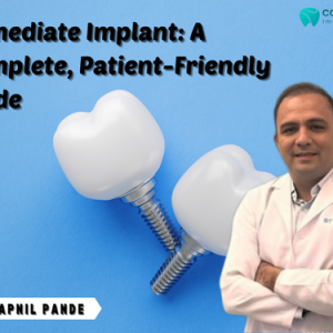 Immediate Implant: A Complete, Patient-Friendly Guide