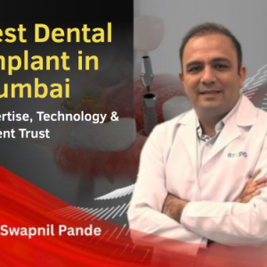 Best Dental Implant In Mumbai