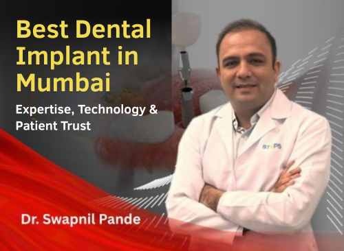 Best Dental Implant In Mumbai