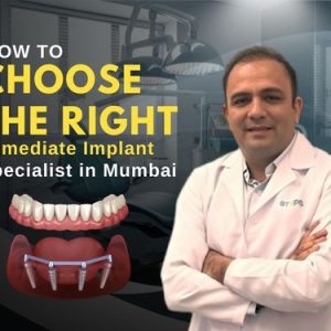 Immediate implant specialist in mumbai