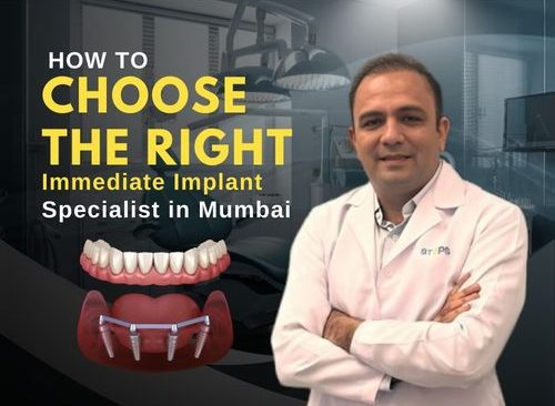 Immediate implant specialist in mumbai