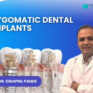 1 Dr. Swapnil Pande explaining Zygomatic dental implants at Richa’s Cosmodent Implant Clinic, Mumbai, showing advanced implant structure for severe bone loss patients.
