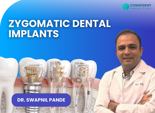 Dr. Swapnil Pande explaining Zygomatic dental implants at Richa’s Cosmodent Implant Clinic, Mumbai, showing advanced implant structure for severe bone loss patients.