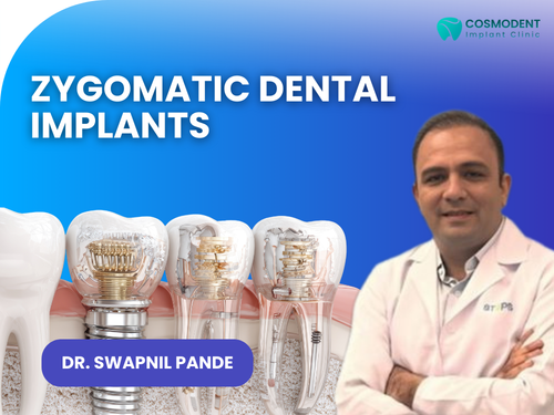 1 Dr. Swapnil Pande explaining Zygomatic dental implants at Richa’s Cosmodent Implant Clinic, Mumbai, showing advanced implant structure for severe bone loss patients.
