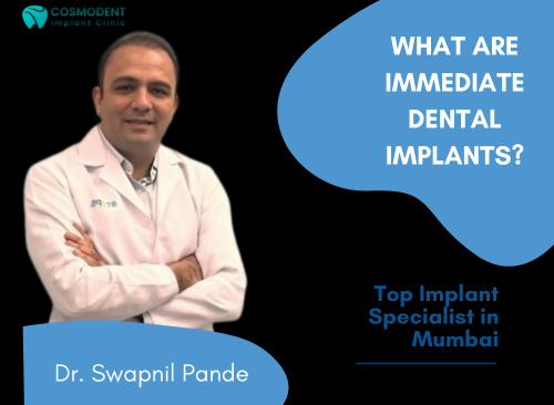Dr. Swapnil Pande top implant specialist in Mumbai | immediate dental implants
