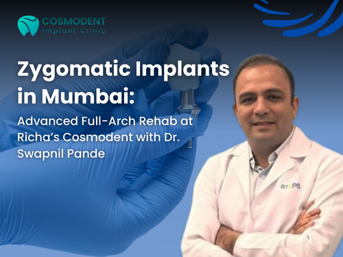 Zygomatic Implants in Mumbai Dr. Swapnil Pande at Cosmodent Implant Clinic, Mumbai, with a banner headline about zygomatic dental implants and full-arch implant solutions.