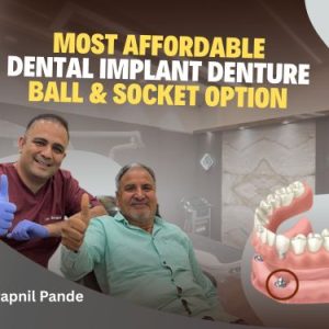 Ball and socket implant denture treatment at Cosmodent Mira Road Mumbai
