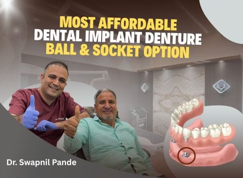 Ball and socket implant denture treatment at Cosmodent Mira Road Mumbai