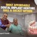 Ball and socket implant denture treatment at Cosmodent Mira Road Mumbai