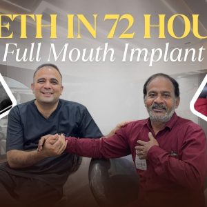 Patient smile transformation after dental implants in Mumbai at Cosmodent Clinic