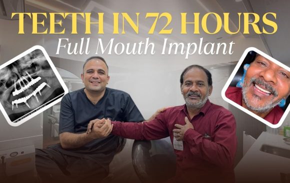 Patient smile transformation after dental implants in Mumbai at Cosmodent Clinic