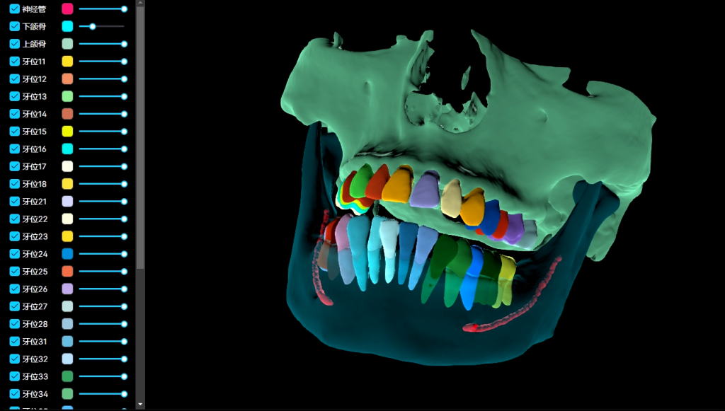 IMPNAV 3D Real-Time Navigation System for advanced robotic dental implant placement in India