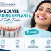 Immediate loading implants for fixed teeth in Mumbai