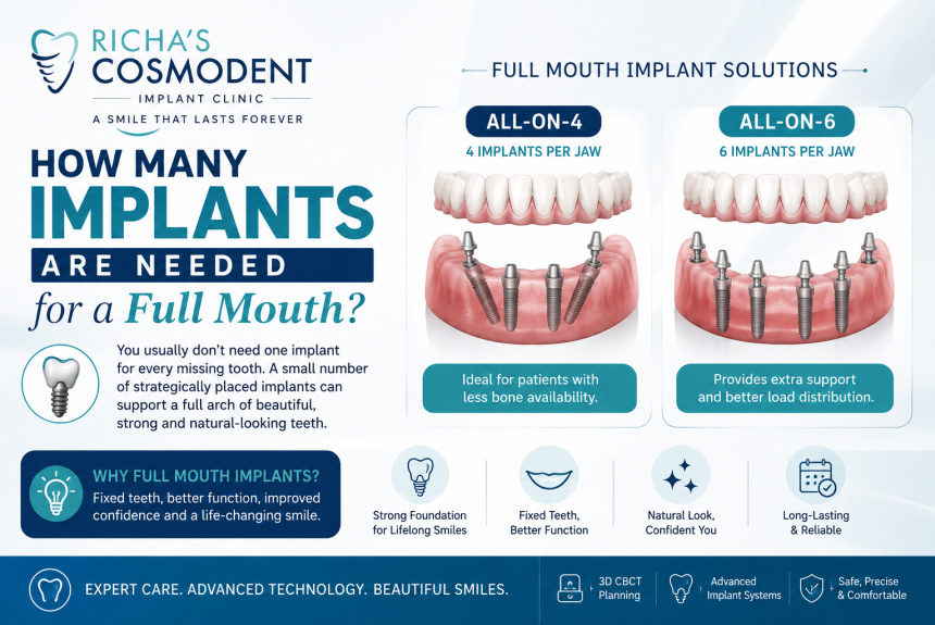 How many implants are needed for a full mouth? Richa's Cosmodent infographic comparing All-on-4 with 4 implants per jaw and All-on-6 with 6 implants per jaw for full mouth dental implants.