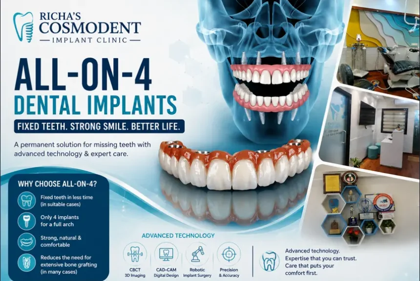 All-on-4 dental implants at a modern implant clinic in Mira Road Mumbai