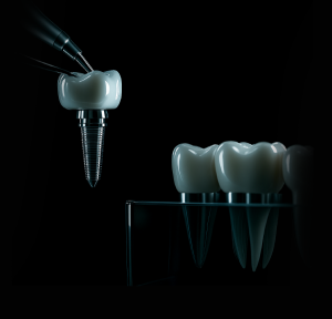 dental implant single tooth image with black background